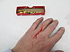 2013_01_10_012_wounded_hand.jpg